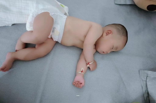 睢县宝宝脸上有白色斑块